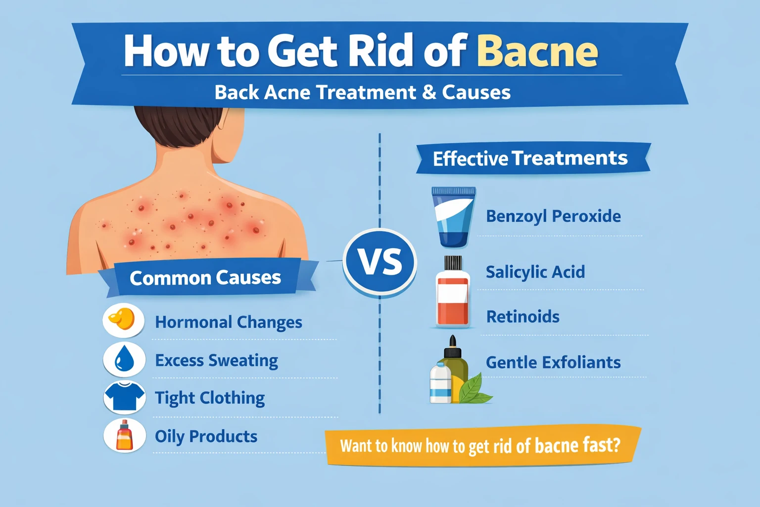 How to Get Rid of Bacne: Causes and Effective Treatments